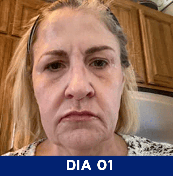 Dia 1