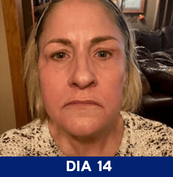 Dia 14
