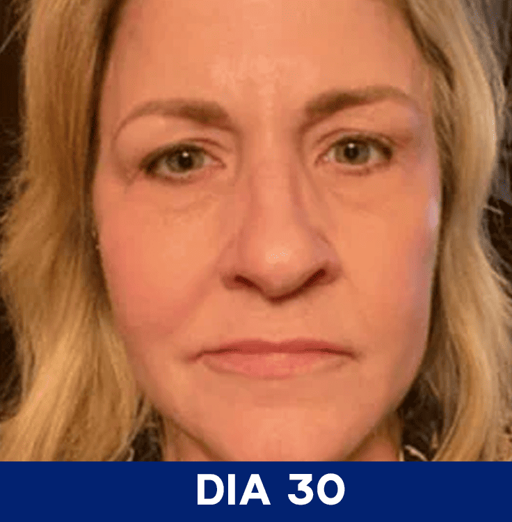Dia 30